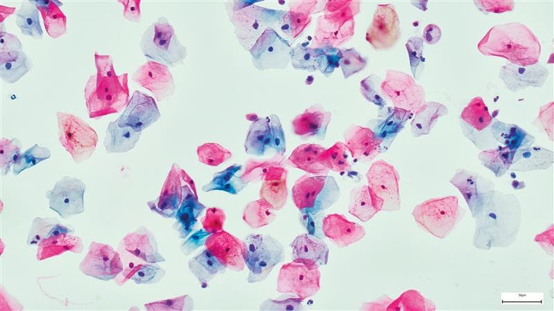 Microscopic image of pancreatic cancer organoids.