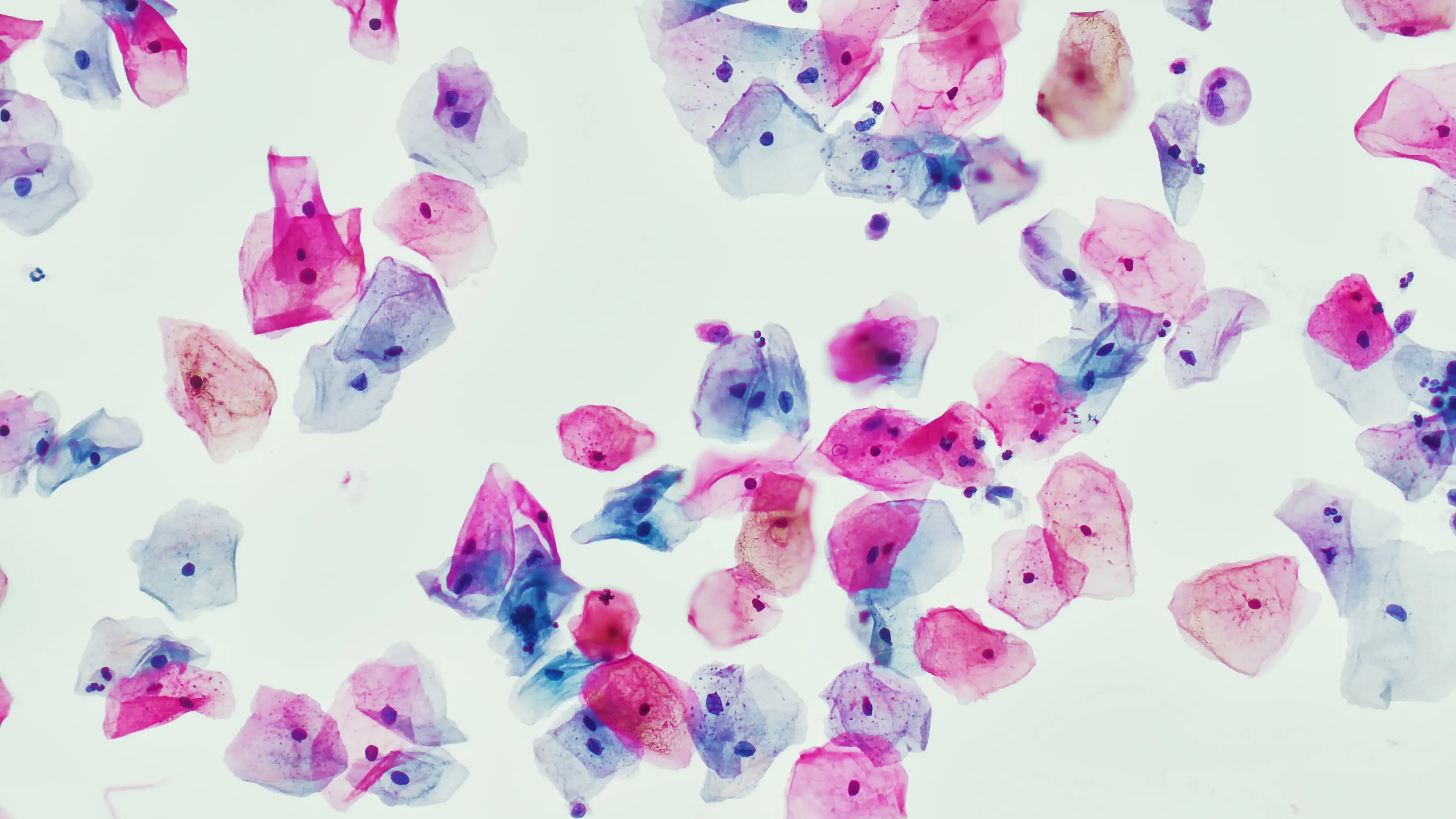 Cervical cancer cells close up.