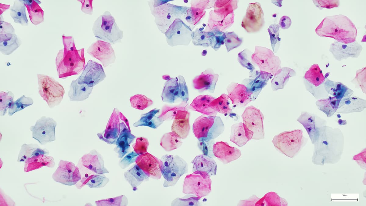 Squamous epithelial cells of human cervix as seen under the microscope.