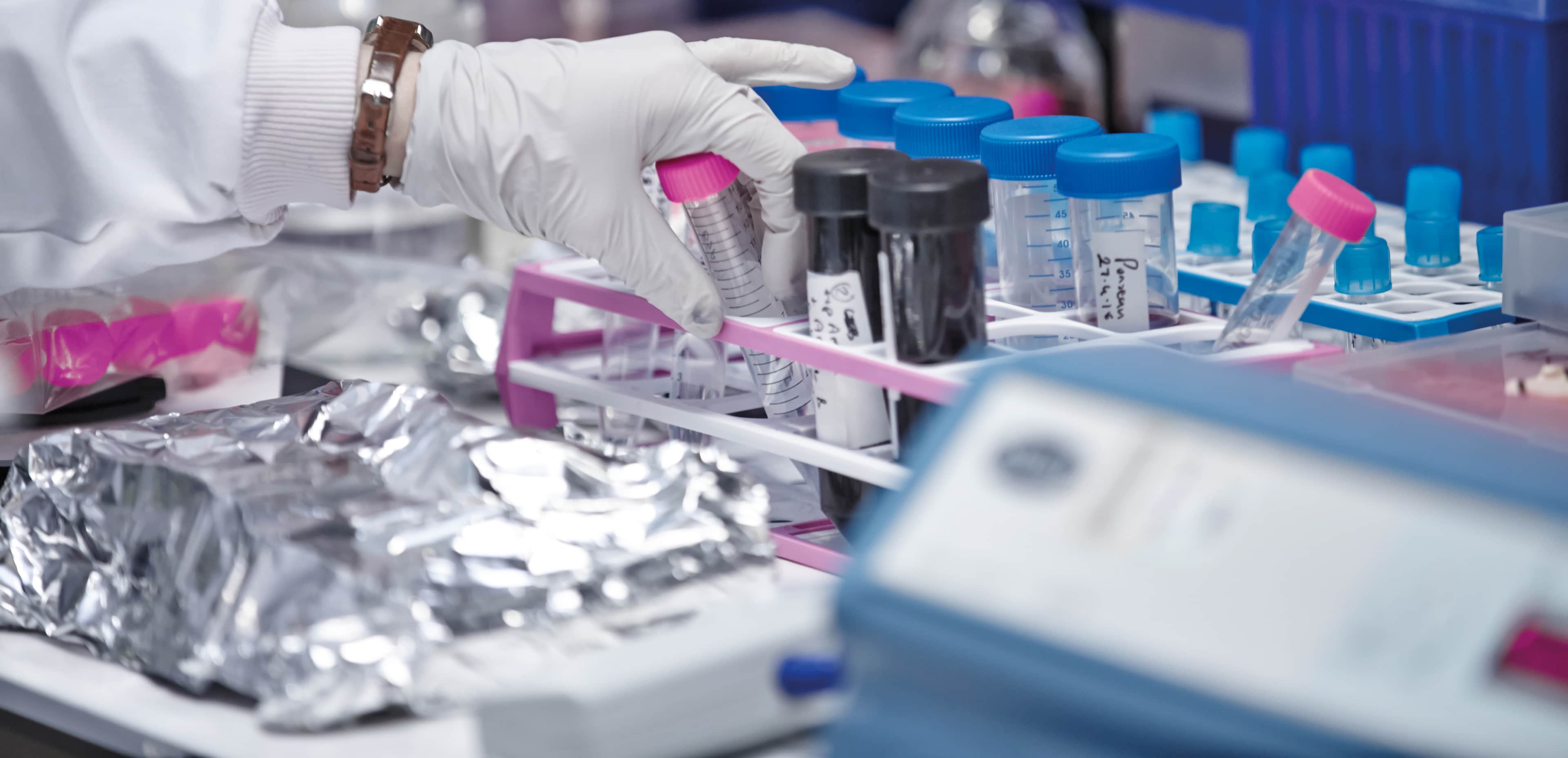 A researcher taking a test tube from one of the racks of test tubes at Oxford Institute for Radiation Oncology.